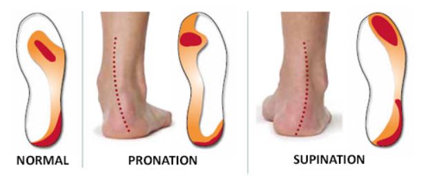 Pronation